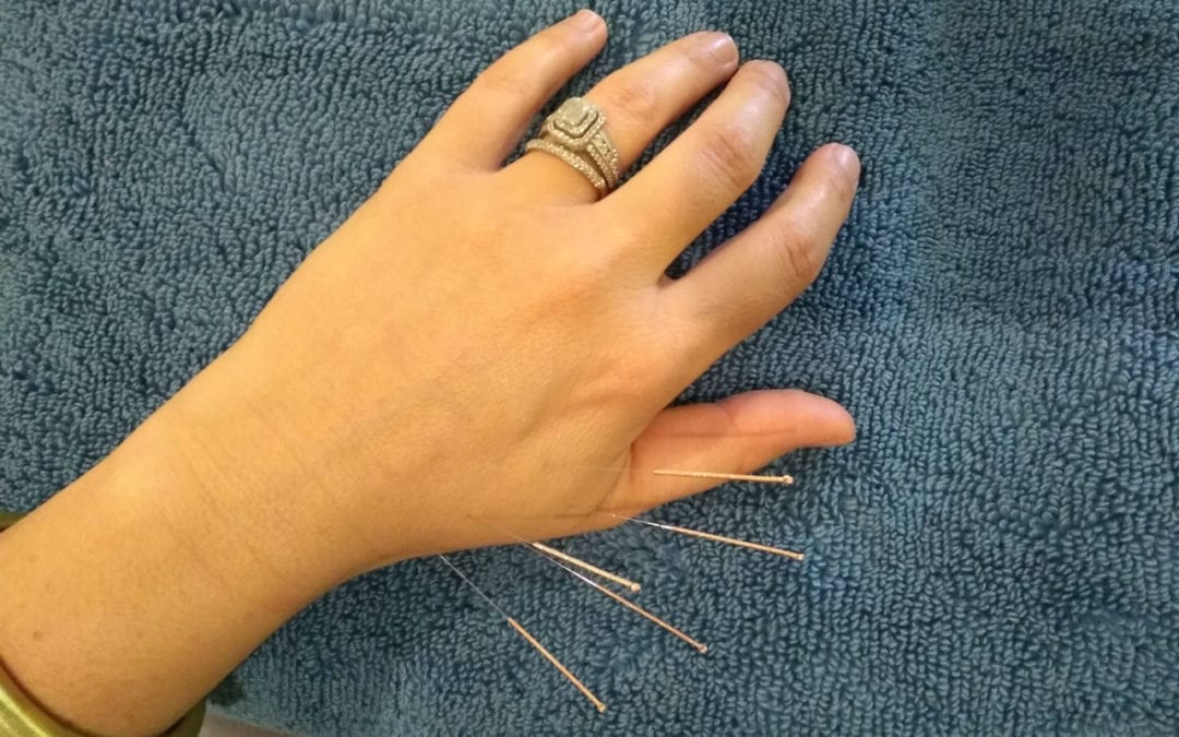 How does Dry Needling work?